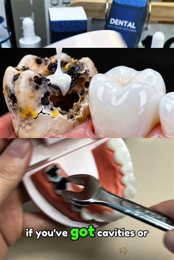 Great,my bad teeth are finally been saved.Just give it a try.#badteeth #badbreath #hydroxyapatite #yellowteeth #teethhealth