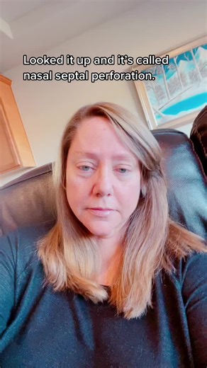 Understanding Nasal Septal Perforation: Causes and Treatment Options