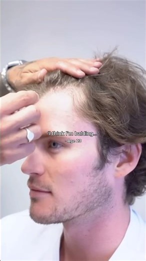‘I think I’m balding…’