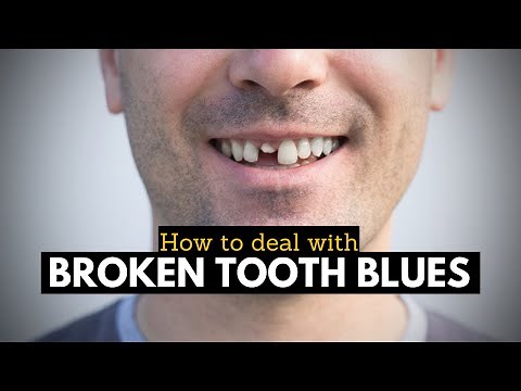 Broken Tooth Blues: Quick Relief and Treatment Options for Pain