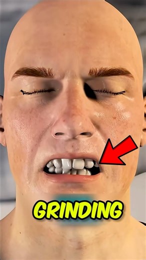 Why Grinding Destroys Teeth 😬