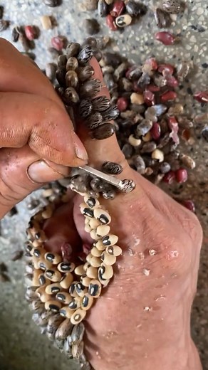 85K views · 191 reactions | OMG Million Ticks #ticks #remove #tick #tickremove #1251 | Orange Clip | Facebook