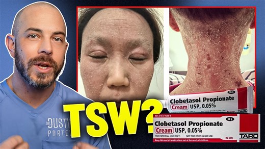 Is Topical Steroid Withdrawal Real? | Dermatologist Answers TSW