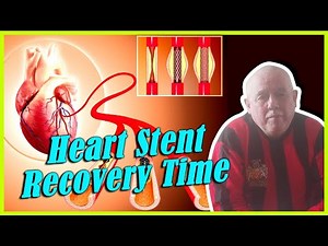 Heart Stent Recovery Time, How Long Does A Stent Last