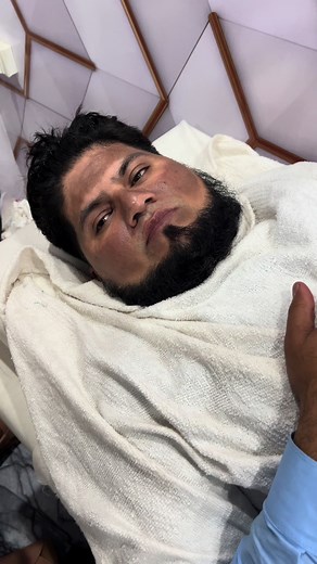 Carbon Treatment for Face | Skincare at MJ Laser Clinic