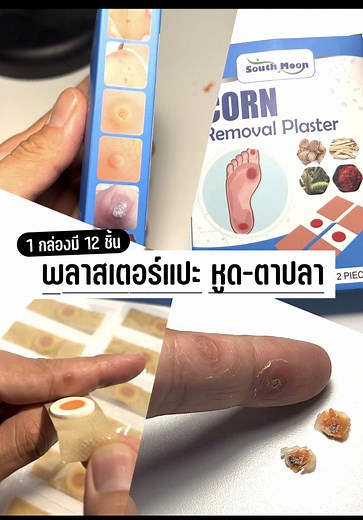 วิธีใช้พลาสเตอร์แปะหูดและตาปลา