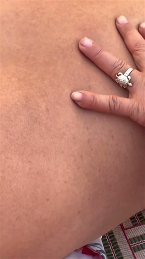 Back Massage Relaxing to sleep😴😴 #asmrtapping #relaxationexercises #relaxingmassage #massagechair