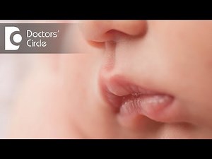 What can cause lip colour changes in infants? - Dr. Shaheena Athif
