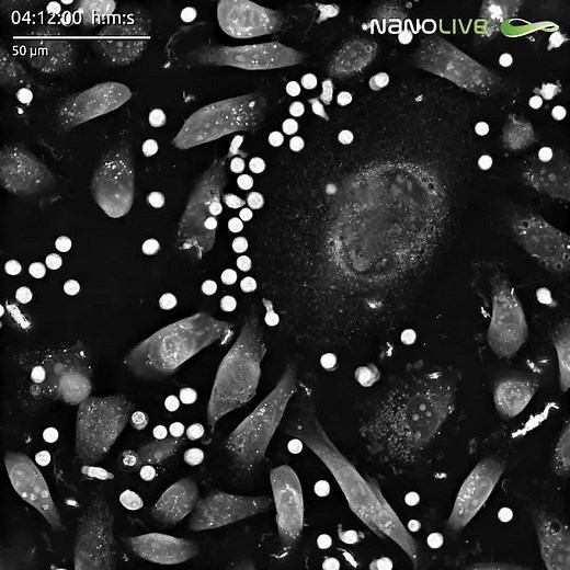Holotomographic imaging of T cells and cancer cells in co-culture