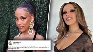 Doja Cat speaks out after getting liposuction and breast surgery