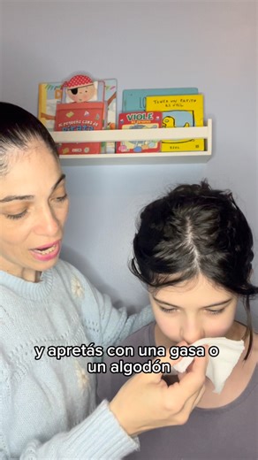 SANGRADO NASAL / EPISTAXIS Pérdida de sangre proveniente de los vasos de las fosas nasales. Es un SÍNTOMA LA MAYORÍA DE LAS VECES SE AUTOLIMITA. Puede ser ANTERIOR O POSTERIOR ANTERIOR El 90 % casos. De leve a moderada. Más en niños y jóvenes. POSTERIOR 10 % casos. Moderada Las CAUSAS pueden ser LOCALES ( traumatismos MUY FRECUENTE EN PEDIATRÍA , fragilidad capilar, inflamación, cuerpos extraños, tumores, irritación química y desviación del tabique nasal) O GENERALES ( infecciones, medicamentos,