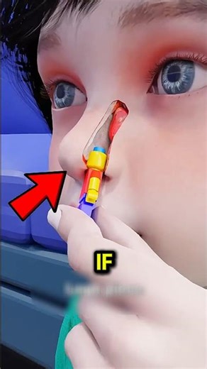 Lego Stuck in Your Nose DO THIS Instead Most People Get It Wrong!