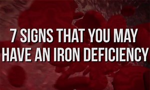 WATCH: Heed These Signs to Know If You're Iron-Deficient