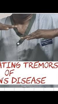 WING BEATING TREMORS! Wilson's disease| #neurology #medicine #mbbs #medicalstudent