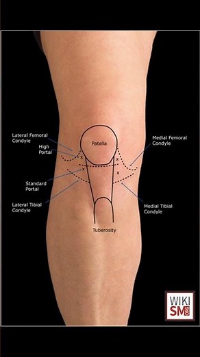 Hoffa Fat Pad Syndrome Explained 🦵#kneepain #anatomy #ortho #physio #ATC #meded