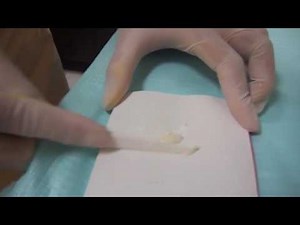 How to Manipulate GC Fuji Luting & Lining Cement Type 1