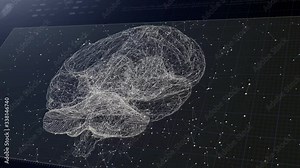 Human brian study on diagnostic computer display.