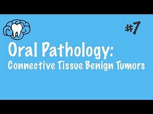 Oral Pathology | Connective Tissue Benign Tumors | INBDE, ADAT