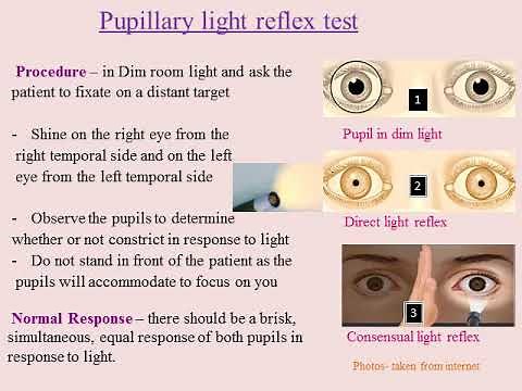Pupillary Light Reflex – what is pupillary light reflex?, pathway of PLR, procedure of PLR test