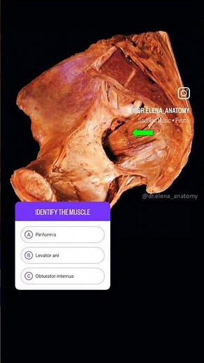 Anatomy Quiz (Identify the muscle)