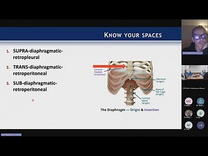 Lateral Corpectomy Technique presented by Donald J. Blaskiewicz, MD on February 10, 2025.