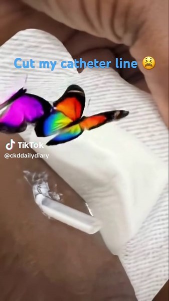 Understanding Chronic Kidney Disease Daily Management