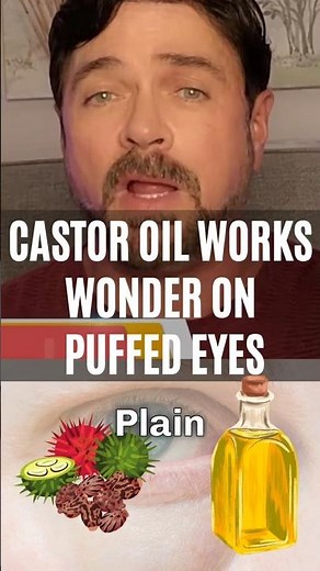 Get Younger Looking Eyes With Castor Oil!