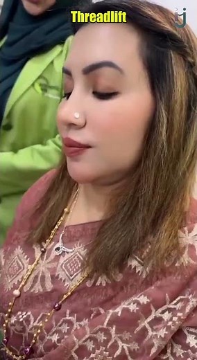 Threadlift Treatment Procedure