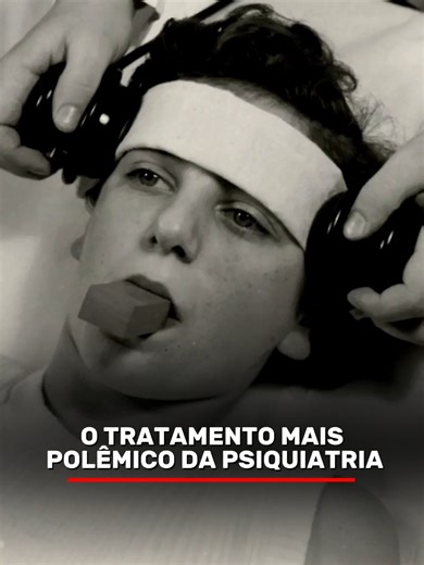 O tratamento mais polêmico da psiquiatria: Eletroconvulsoterapia #saudemental #psicologia #fyp
