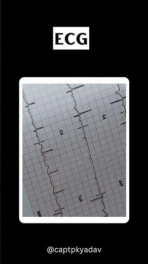 Class 2 Medical tests required to become a pilot | DGCA Class II medical | DGCA Doctors | Pilot Med