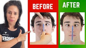 25 reactions · 4 comments | In this video, Annette shows you how to FIX your lazy eye | Posturepro | Facebook