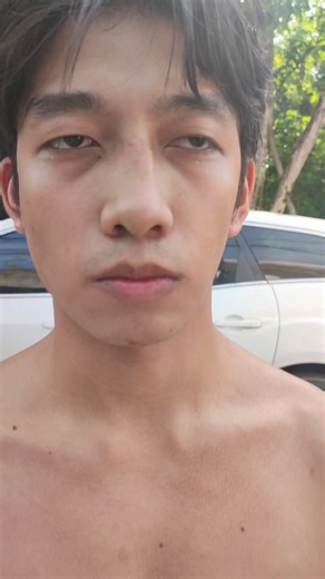 Dislocated nose | 3m massage