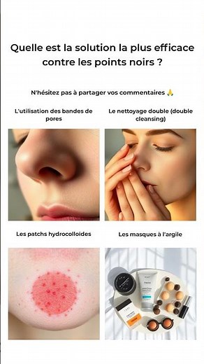 Top 4 méthodes contre les points noirs!