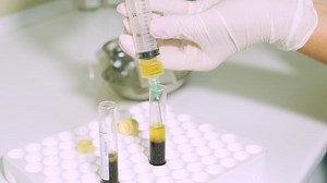 Platelet-Rich plasma preparation. Plasma in syringe. Centrifuge. Background 2