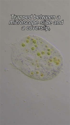 Final Moments of a Ciliate #biology #nature #microscope #sciencefacts #science #interestingfacts