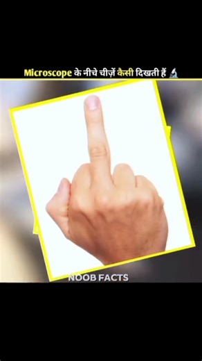 How Do These Things Look Under a Microscope 🔬#shorts #facts