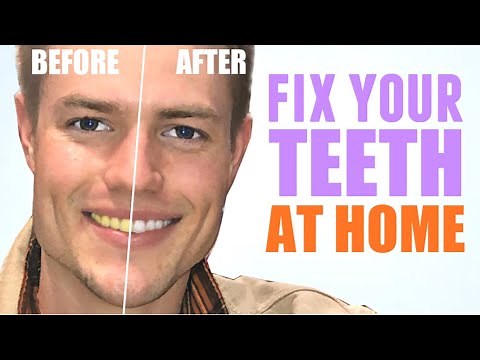 How To Get Beautiful Teeth Without Going to a Dentist!