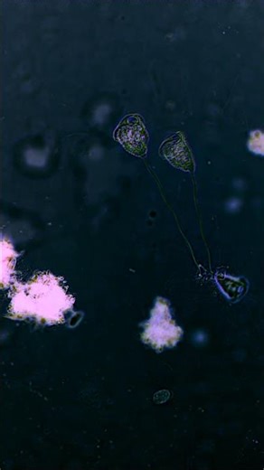 Vorticella whirring and feeding under the microscope 😳🔬🦠