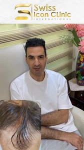 2.2K reactions · 93 shares | نتيجة رائعة لزراعة ٢٩٠٠ جرافت بعد ٧ اشهر...