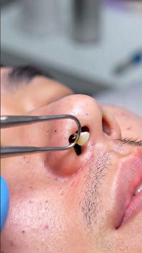 Deep Clean Pores Instantly