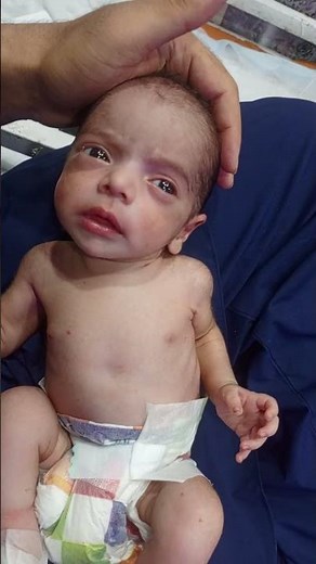 "Newborn Meningitis | Dangerous Infection in Babies 🧠💔#Meningitis #NewbornCare #NICUBaby#liveviedo