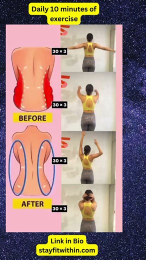 10-Minute Morning Exercise Routine | Slim Waist & Flat Stomach