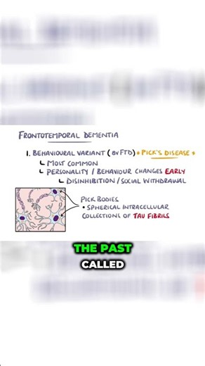 Dementia's Personality-Changing Type