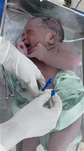 Just delivery newborn cord clamp process #cutebaby #newborn #youtubeshorts #viralvideo