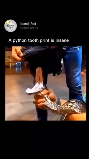 brandi focus on Instagram: "Pythons may not possess venom, but their power lies in precision and pressure. These massive constrictors use rows of sharp, backward-curved teeth to grip their prey firmly before wrapping their muscular coils to suffocate it. Their bite often leaves behind distinctive, crescent-shaped tooth marks — a reminder of nature’s intricate design for survival and dominance. #pythonfacts #wildlife #nature #reptiles #animalbehavior #discovery #science #knowledge #wildlifewonder