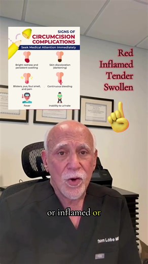 The 2 most frequent types of circumcision procedures done today are called Plastibell and Gomco clamp. These are named after the devices used to perform the procedures. I’ll describe these circumcision procedures themselves as well as give tips for proper post procedure after care #circumcision #babyboy #babiesoftiktok #momsoftiktok