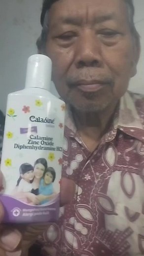 Manfaat Caladine Lotion untuk Mengatasi Gatal dan Alergi Kulit