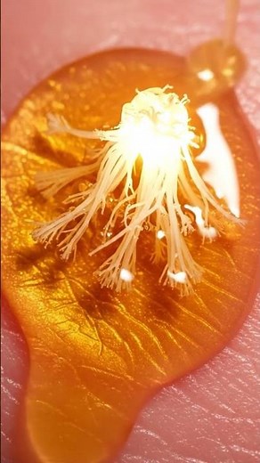The Living Fungus Causing Your Dandruff 🍄