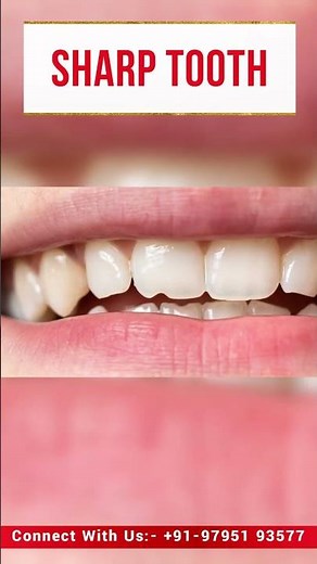 Bitten Your Tongue? Here’s When It Becomes Serious | Dr Amit Pandey| #dentalclinic #shorts
