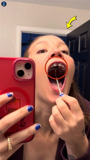 This Device Makes Your Mouth Bigger!😱#shorts